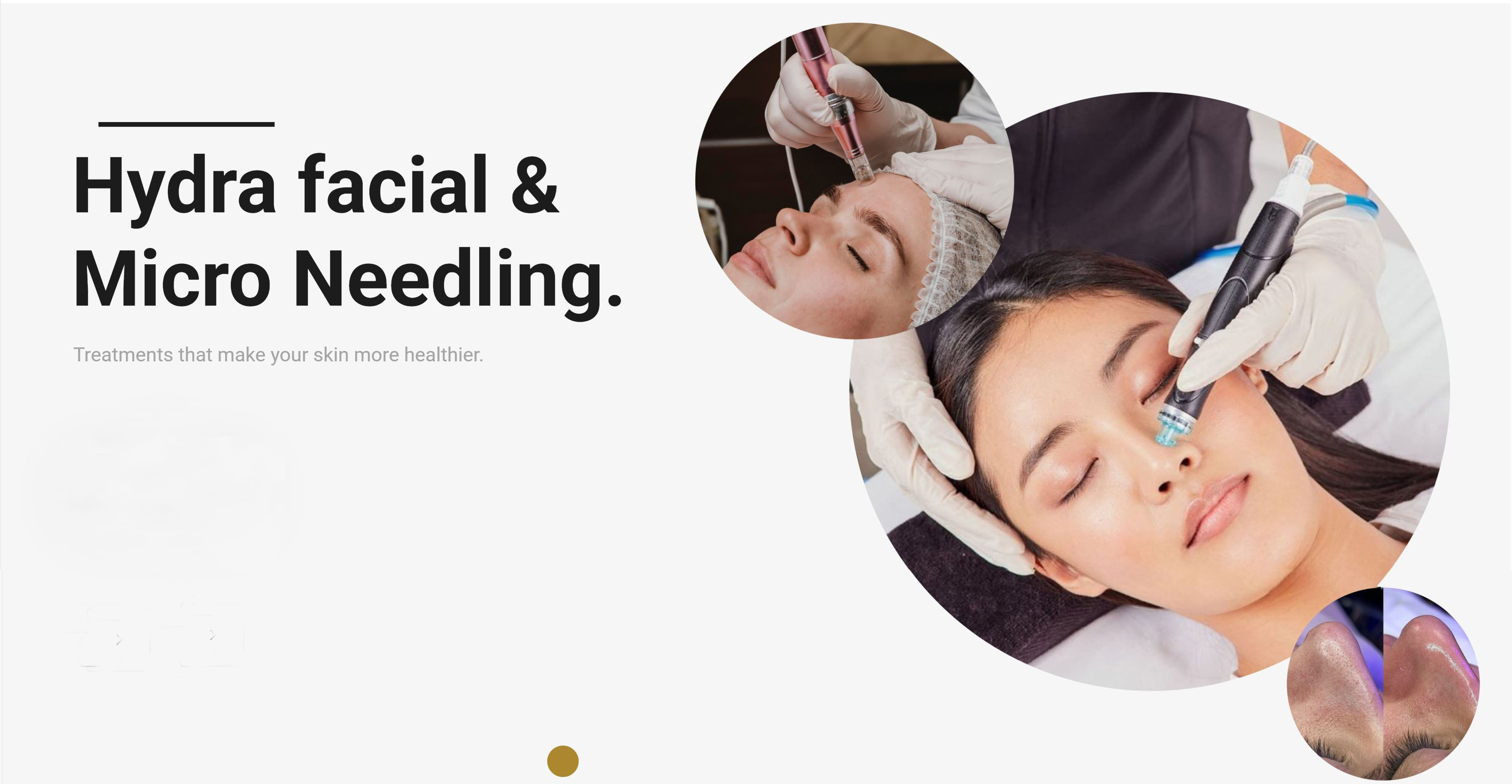 Alma TED Hair Restoration